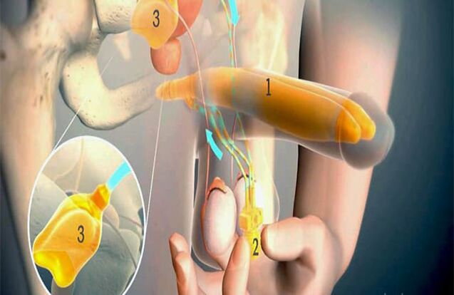 Lipofilinimo operacija